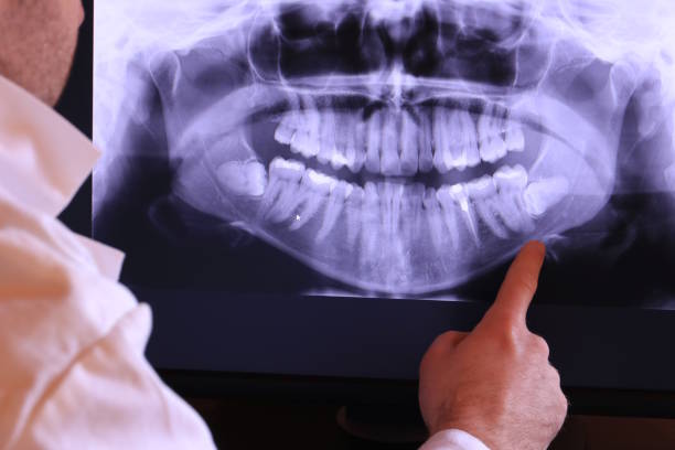 Best Broken or Cracked Tooth Emergency Dentist in Yelm, WA