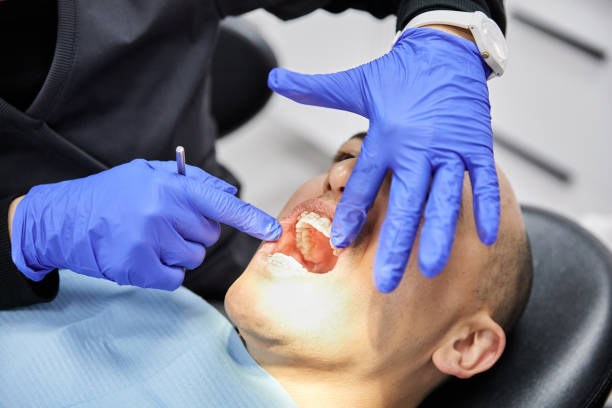 Best Emergency Dentist for Lost Fillings or Crowns in Yelm, WA
